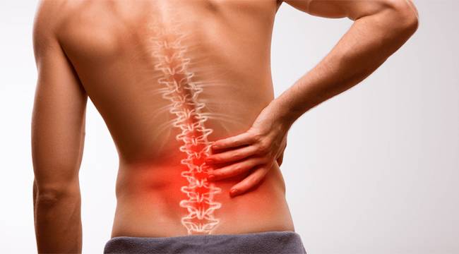 BEL FITIĞI VE TEDAVİSİ