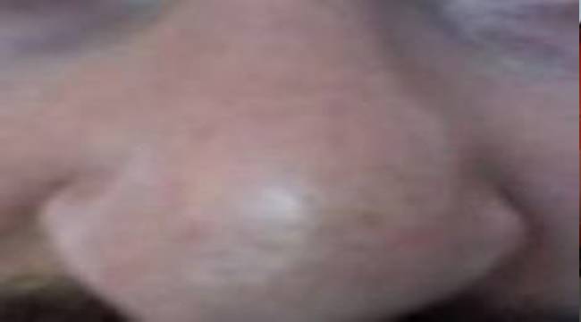 İMAM, ÖĞRENCİNİN BURNUNU KIRDI