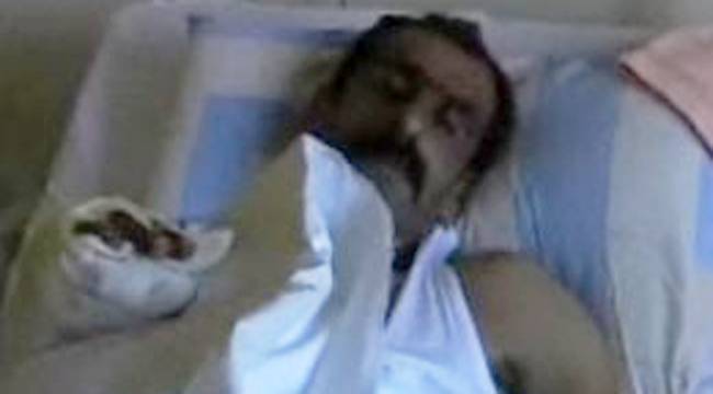 RİZE'DE BİR İLK, KOPAN PARMAK YERİNE DİKİLDİ