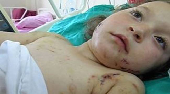 DUYGU'YA SALDIRAN KÖPEĞİN SAHİBİ KONUŞTU