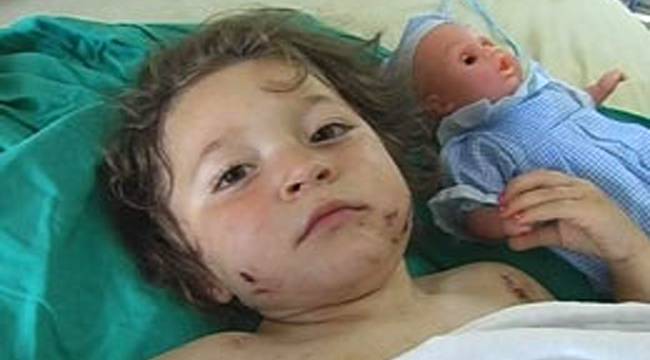 RİZE'DE ROTTWEİLER DEHŞETİ